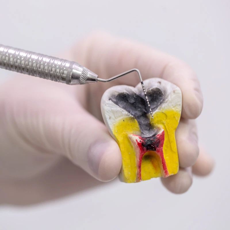 Trattamenti dentali conservativi