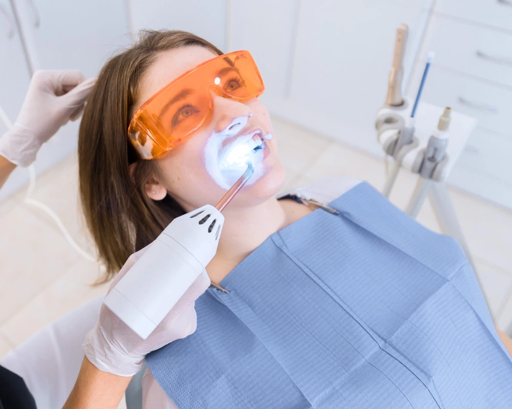 Estetica del sorriso